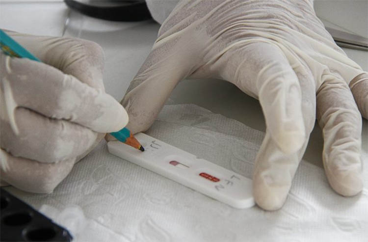 MS registra seis mortes e 272 casos de covid na primeira semana epidemiolÃ³gica de 2024